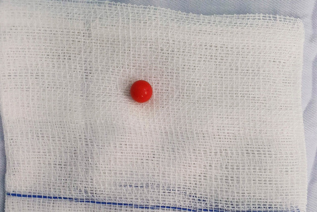 Be gai Hau Giang nhet bi vao am dao de tai di chung vung kin?-Hinh-2