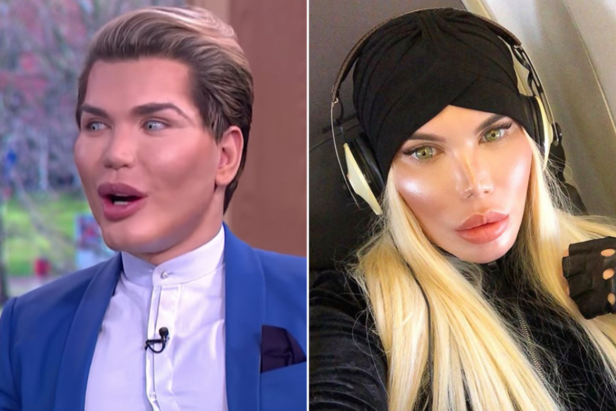 Rodrigo Alves, sống ở London (Anh) được mệnh danh là "búp bê sống" Ken sau khi trải qua hàng chục ca phẫu thuật để có được diện mạo hoàn mỹ nhưng giờ đây, anh tiết lộ đang chuyển giới thành phụ nữ.