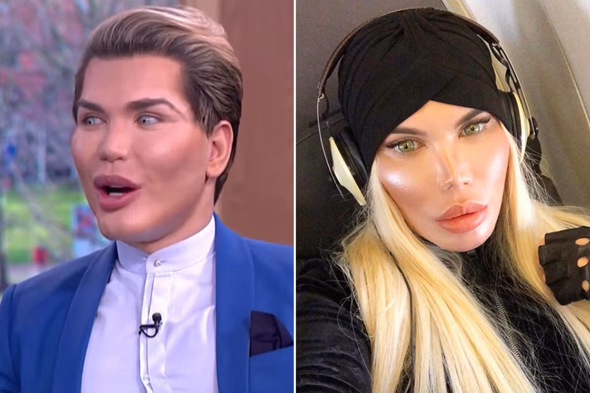 Rodrigo Alves, sống ở London (Anh) được mệnh danh là "búp bê sống" Ken sau khi trải qua hàng chục ca phẫu thuật để có được diện mạo hoàn mỹ nhưng giờ đây, anh tiết lộ đang chuyển giới thành phụ nữ.