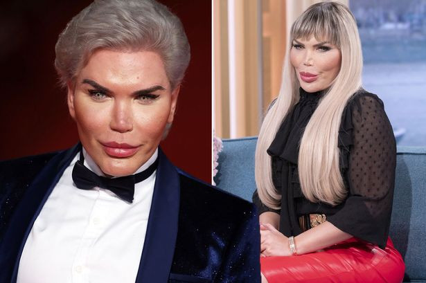 Đến hiện tại, Rodrigo đã trải qua hơn 70 ca phẫu thuật thẩm mỹ để có được diện mạo hoàn mỹ và được nhắc đến với biệt danh "búp bê sống", hay gương mặt của làng thẩm mỹ.