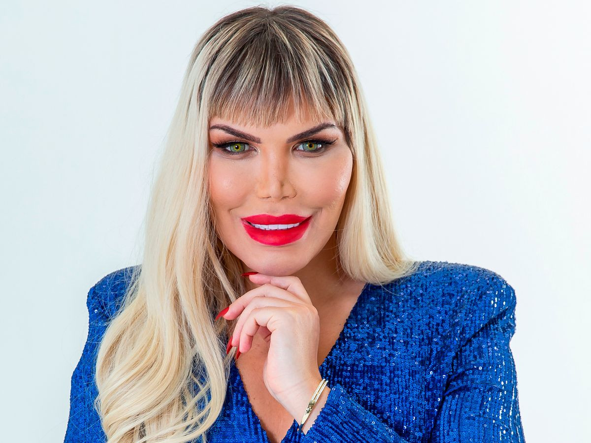 Về gương mặt có lẽ Rodrigo đã sửa không sót chi tiết nào, thậm chí sửa đi sửa lại nhiều lần. Ví dụ như chiếc mũi chẳng hạn, Rodrigo đã sửa đến suýt hoại tử. Ngoài ra, anh chàng 36 tuổi còn phẫu thuật tạo cơ 6 múi, cắt 4 xương sườn...