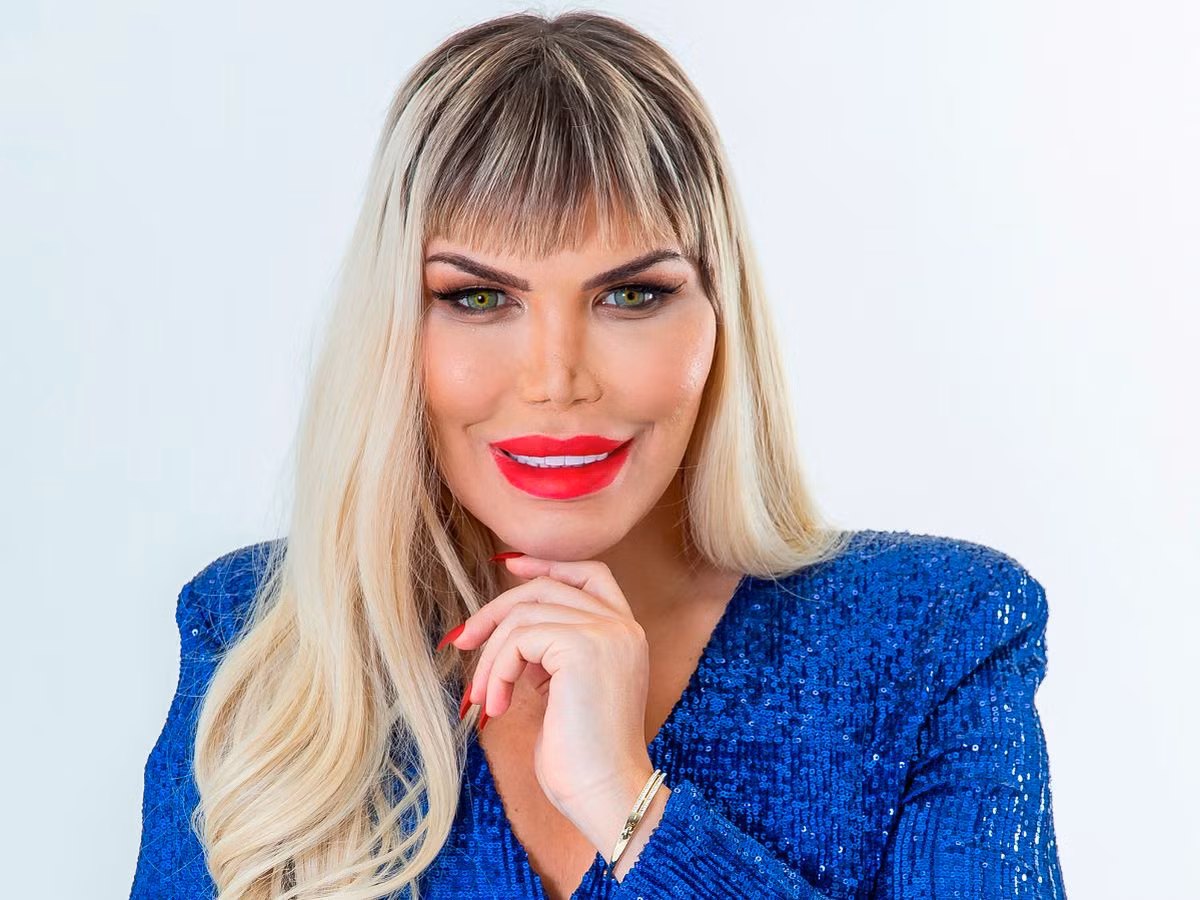 Về gương mặt có lẽ Rodrigo đã sửa không sót chi tiết nào, thậm chí sửa đi sửa lại nhiều lần. Ví dụ như chiếc mũi chẳng hạn, Rodrigo đã sửa đến suýt hoại tử. Ngoài ra, anh chàng 36 tuổi còn phẫu thuật tạo cơ 6 múi, cắt 4 xương sườn...