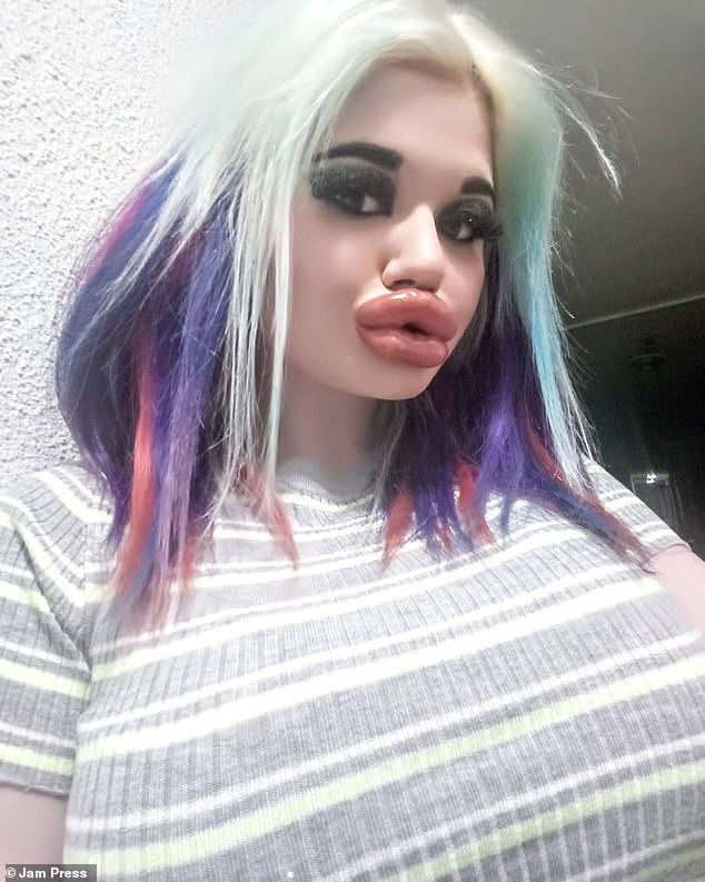 Tuy đã qua 20 lần bơm môi, cô vẫn chưa hài lòng và muốn thực hiện tiếp để trở thành một trong những người có đôi môi lớn nhất thế giới.