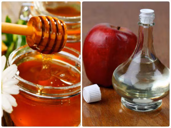 5 cách chữa viêm xoang đơn giản và hiệu quả tại nhà bằng giấm táo - Hình 3 5 cach chua viem xoang don gian va hieu qua tai nha bang giam tao-Hinh-3