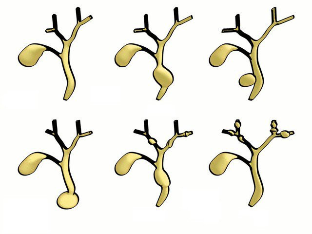 Benh teo duong mat bam sinh cua con gai BTV dai VTV cuc nguy hiem-Hinh-2