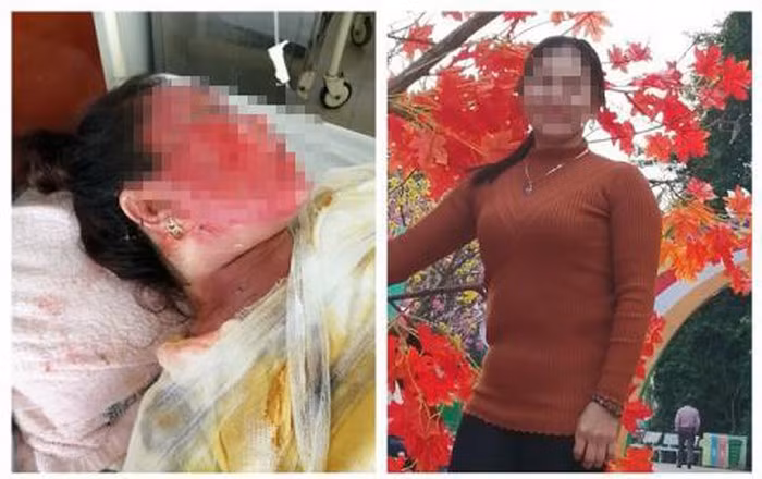 Do nuoc soi len dau vo vi choi khuya khong khoa cua