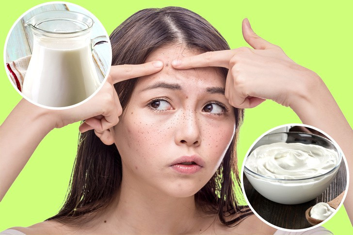 Sữa chua để mát trong tủ lạnh khi đắp lên da khoảng 20 phút cũng làm cho phần da bị cháy nắng được sạch và mát hơn.