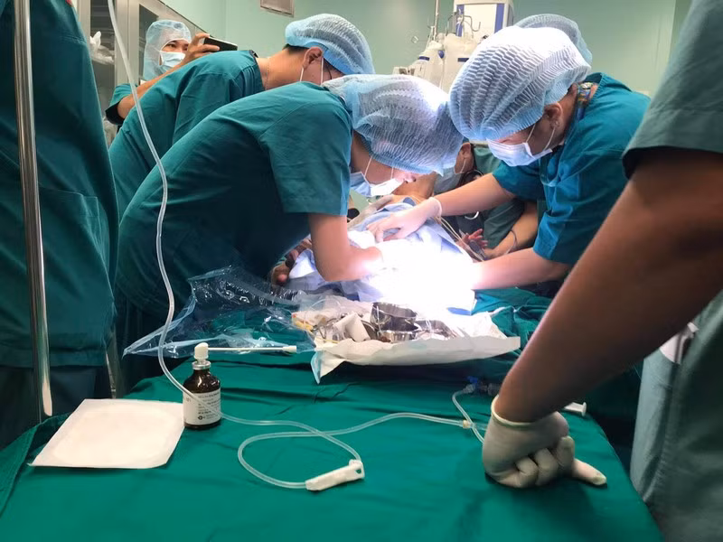 Các bác sĩ nhận định đây là trường hợp song sinh dính nhau vùng bụng chậu với 4 chân tách rời theo kiểu ischiopagus tetrapus (quadripus) cực kì hiếm gặp. Ảnh: PLO.