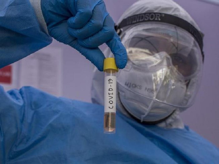 Benh nhan COVID-19 thu 22 khoi benh... tai duong tinh: Nguy co lay lan phuc tap?-Hinh-2