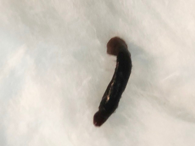 Theo lời kể của bệnh nhân, nửa tháng trước ngày nhập viện, khi đi làm đồng về, bà lấy tay vốc nước suối rửa mặt sau đó về nhà nhìn thấy rõ có con vắt trong mắt. Bác sĩ cảnh báo, thói quen rửa mặt dưới suối của người dân dễ khiến đỉa, vắt chui vào cơ thể mà không hề hay biết.