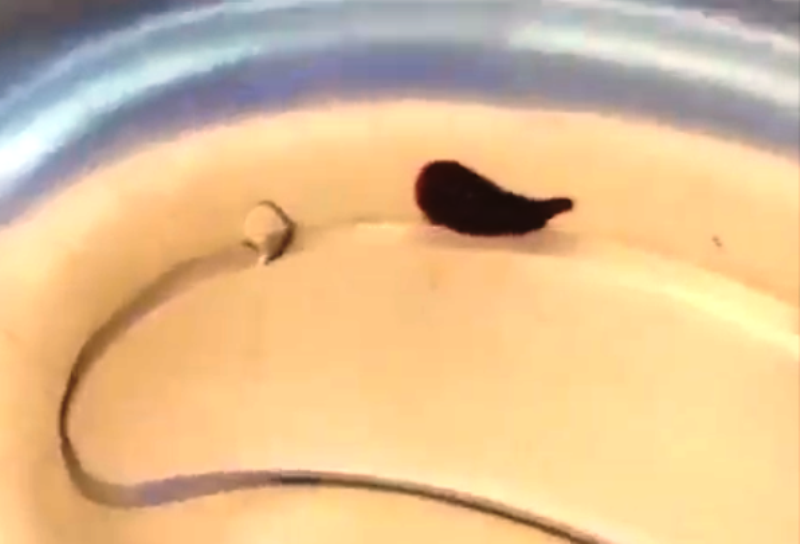 Tháng 2/2019, Phòng khám Đa khoa Đoàn Kết (huyện miền núi Quỳ Hợp, Nghệ An) cho biết, các y tá, BS đã nội soi gắp ra một con vắt dài 5cm trong mũi bệnh nhân Trương Thị T. (57 tuổi, trú xã Châu Hồng, huyện Quỳ Hợp). Nguyên nhân có thể do bệnh nhân đi rừng, vục nước suối rửa mặt, con vắt nhỏ có trong nước suối nhảy vào mũi, hút máu và lớn lên trong mũi.