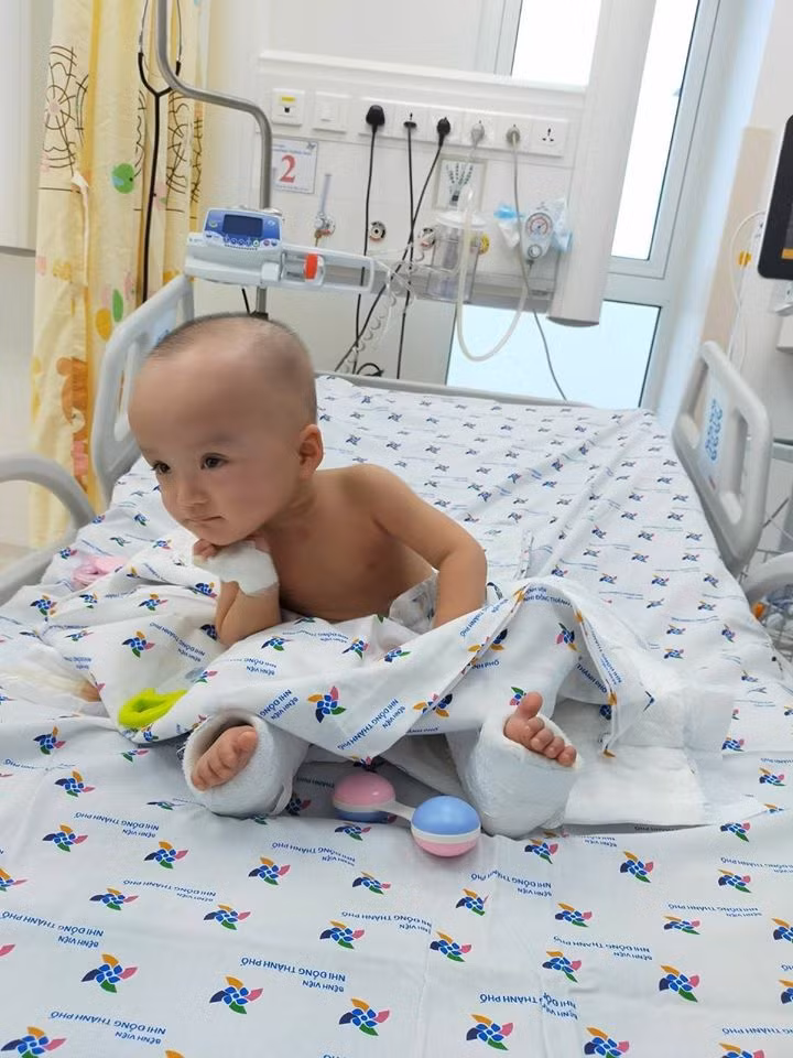 Bệnh viện Nhi đồng thành phố cho biết sau 25 ngày mổ tách dính, hiện sức khỏe của Trúc Nhi - Diệu Nhi có nhiều tiển triển tích cực. Hai em lanh lợi, hoạt bát, hợp tác tập vật lý trị liệu tốt.