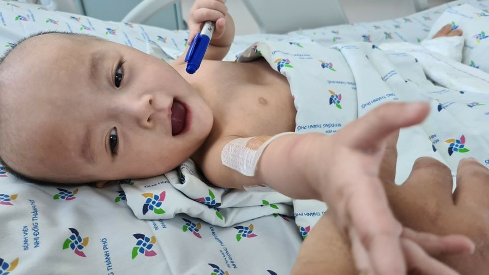 TS.BS Trương Quang Định - Giám đốc Bệnh viện Nhi đồng Thành phố - cho biết trong vòng 3 tháng tới, hai bé phải trải qua thêm 4 cuộc đại phẫu để tạo hình khung chậu, tiết niệu, tiêu hóa và tầng sinh môn. Ảnh: FBBV.