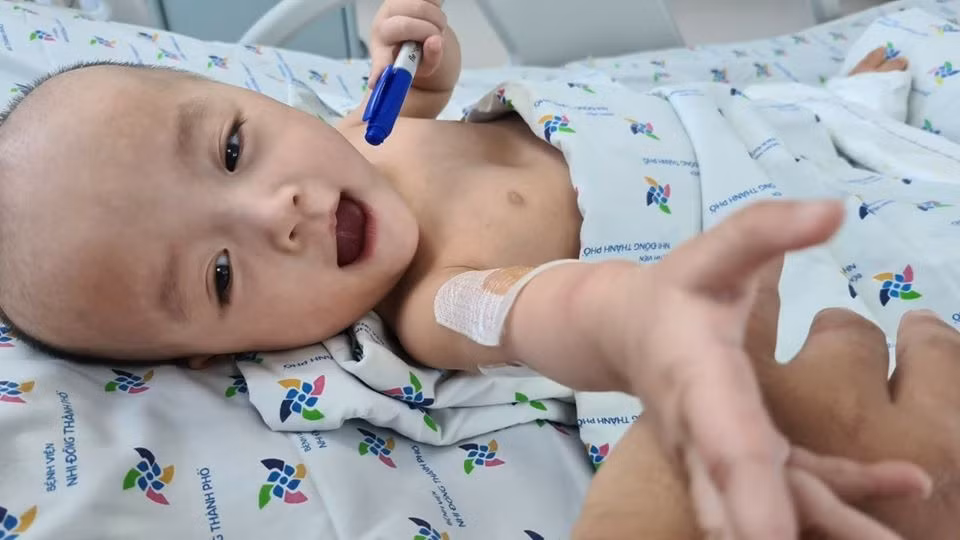 TS.BS Trương Quang Định - Giám đốc Bệnh viện Nhi đồng Thành phố - cho biết trong vòng 3 tháng tới, hai bé phải trải qua thêm 4 cuộc đại phẫu để tạo hình khung chậu, tiết niệu, tiêu hóa và tầng sinh môn. Ảnh: FBBV.