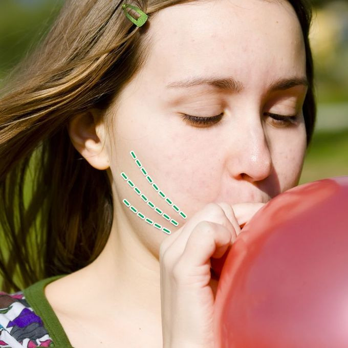 Thổi bóng: Thổi bóng cũng là bài tập thể dục tốt cho cổ và mặt. Việc thổi bóng có tác dụng tương tự như huýt sáo.