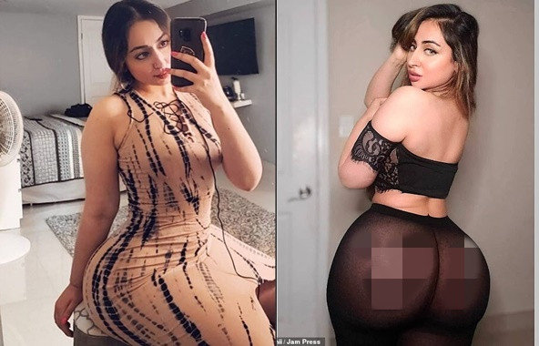 Gai xinh chi bon tien phau thuat nang mong de roi nhan ket dang-Hinh-2