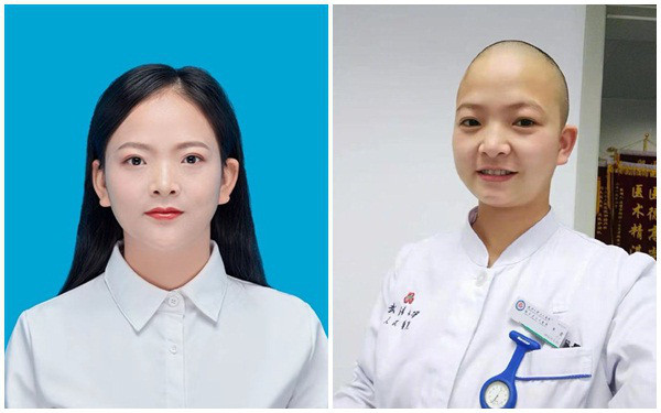 Nữ y tá 30 tuổi Chan Xia, y tá tại Bệnh viện Renmin, Đại học Vũ Hán, đã quyết định cạo đi mái tóc dài của mình tránh lây nhiễm chéo, đồng thời tiết kiệm thời gian khi mặc và cởi bỏ bộ đồ bảo vệ khi điều trị cho các bệnh nhân. Shan Xia là một y tá đang làm việc tại tâm dịch Corona Vũ Hán.