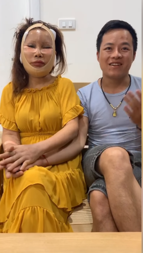 Trước đó, chị Thu Sao đã tiến hành nhấn mí, hút mỡ, bơm mỡ tự thân, hút mỡ cấy mu bàn tay và làm răng sứ.