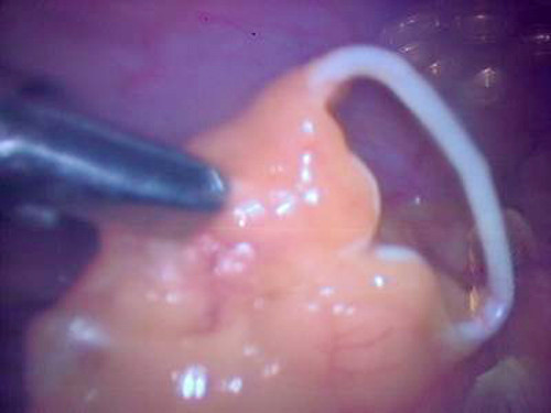 Be trai “doi” vong tranh thai: Seri chuyen ly ky ve chi em tranh thai...-Hinh-3