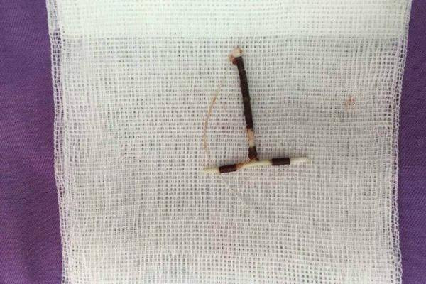 Be trai “doi” vong tranh thai: Seri chuyen ly ky ve chi em tranh thai...-Hinh-2