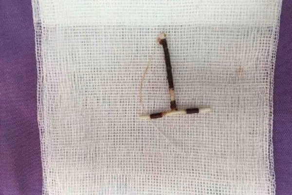 Bé trai “đội” vòng tránh thai: Seri chuyện ly kỳ về chị em tránh thai... - Hình 2 Be trai “doi” vong tranh thai: Seri chuyen ly ky ve chi em tranh thai...-Hinh-2