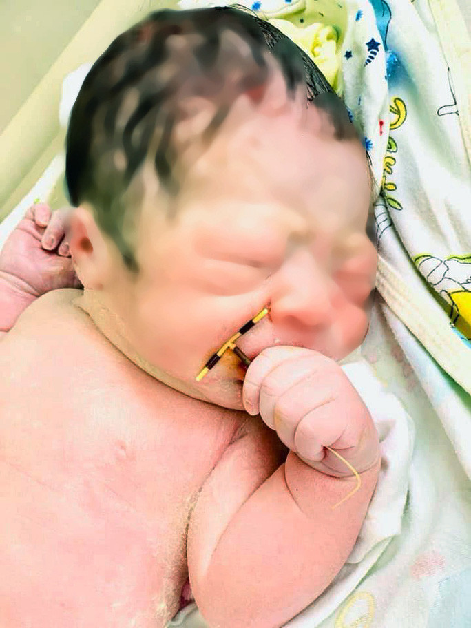 Be trai “doi” vong tranh thai: Seri chuyen ly ky ve chi em tranh thai...