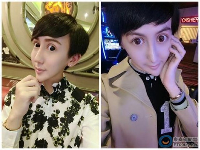 Với mong muốn trở thành người nổi tiếng, Lưu Tử Thần đã nhờ đến "dao kéo" để thay đổi hình ảnh của mình, mong khán giả đón nhận. Tuy nhiên, sau khi trải qua phẫu thuật trở thành "hot boy mặt rắn", Tử Thần đã khiến cư dân mạng không khỏi giật mình.