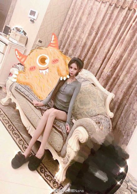 Năm 2017, vào thời điểm Nana bắt đầu phẫu can thiệp "dao kéo" cô thừa nhận mình trông không được xinh đẹp và muốn thay đổi điều đó, dần dần cô yêu việc phẫu thuật thẩm mỹ.