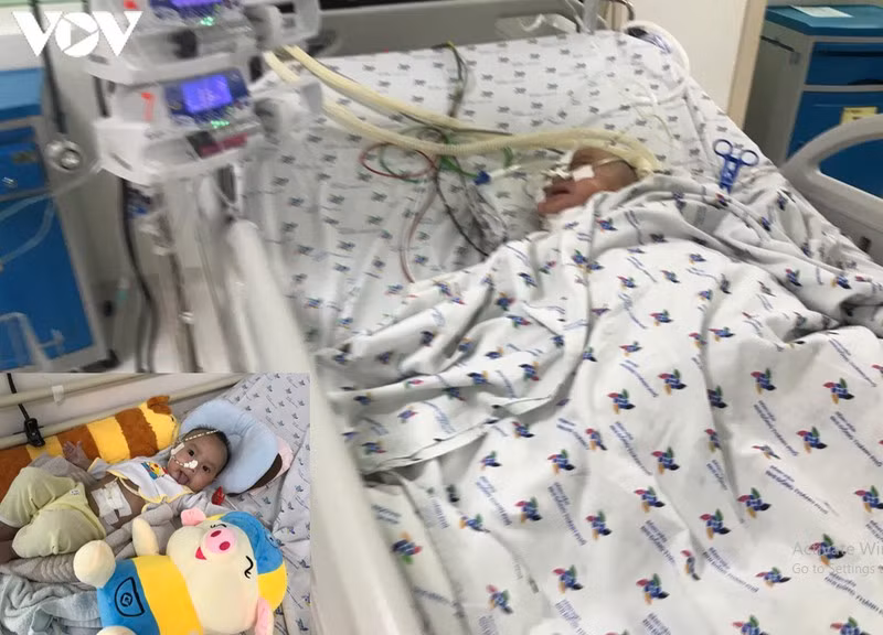 Be trai 6 thang tuoi nguy kich vi hoc xuong luon: An dam an toan?