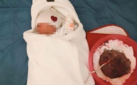 Bộ Y tế khuyến cáo không nên tự sinh con tại nhà. Ảnh minh họa.