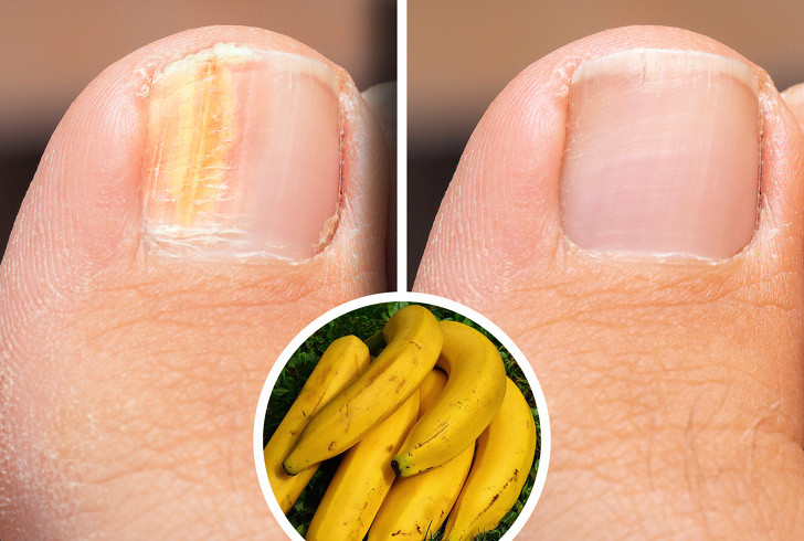 Ăn các thực phẩm giàu biotin: Để móng tay, tóc mọc dài, phục hồi nhanh hơn bạn nên ưu tiên nhóm thực phẩm giàu biotin như nội tạng động vật, các loại nấm, hạt, trứng, chuối…