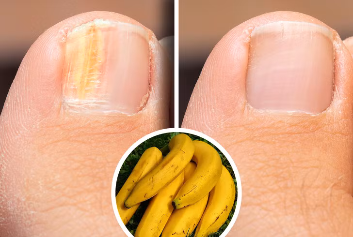 Ăn các thực phẩm giàu biotin: Để móng tay, tóc mọc dài, phục hồi nhanh hơn bạn nên ưu tiên nhóm thực phẩm giàu biotin như nội tạng động vật, các loại nấm, hạt, trứng, chuối…