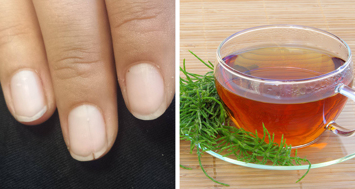 Uống trà đuôi ngựa: Trà đuôi ngựa được chứng minh là có chất chống oxy hóa và đặc tính chống viêm. Uống 2 tách trà thảo mộc đuôi ngựa là một cách đơn giản và dễ dàng để duy trì móng tay chắc khỏe và giữ cho chúng không bị giòn gãy.