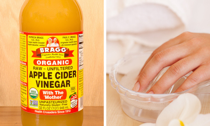 Bạn cũng có thể dùng giấm để điều trị móng bị nhiễm nấm bằng cách ngâm tay trong dung dịch nước và giấm táo theo tỷ lệ 1:1 khoảng 30 phút. Ngoài ra, bạn cũng có thể thoa trực tiếp giấm táo lên vùng da cần khắc phục.