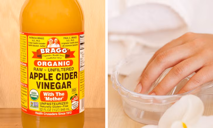 Bạn cũng có thể dùng giấm để điều trị móng bị nhiễm nấm bằng cách ngâm tay trong dung dịch nước và giấm táo theo tỷ lệ 1:1 khoảng 30 phút. Ngoài ra, bạn cũng có thể thoa trực tiếp giấm táo lên vùng da cần khắc phục.