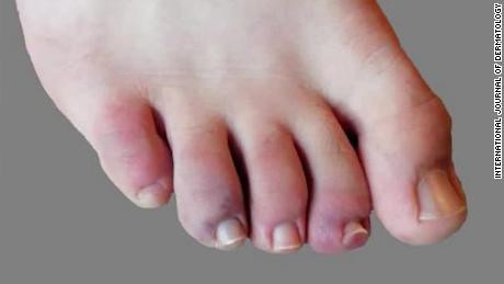 Can benh COVID-19 tan cong co the con nguoi kinh khung the nao?-Hinh-3