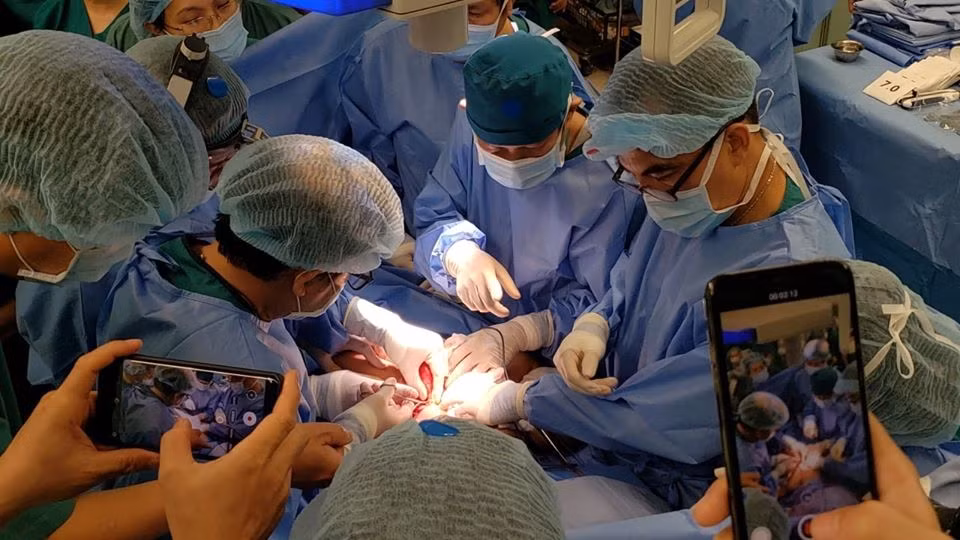 Cuộc đại phẫu có sự tham gia của GS.BS Trần Đông A, nguyên là Trưởng kíp mổ tách dính cặp song sinh Việt - Đức gần 30 năm trước. Theo đánh giá của các y bác sĩ, tỉ lệ cứu sống 2 bé Trúc - Diệu là 74%.
