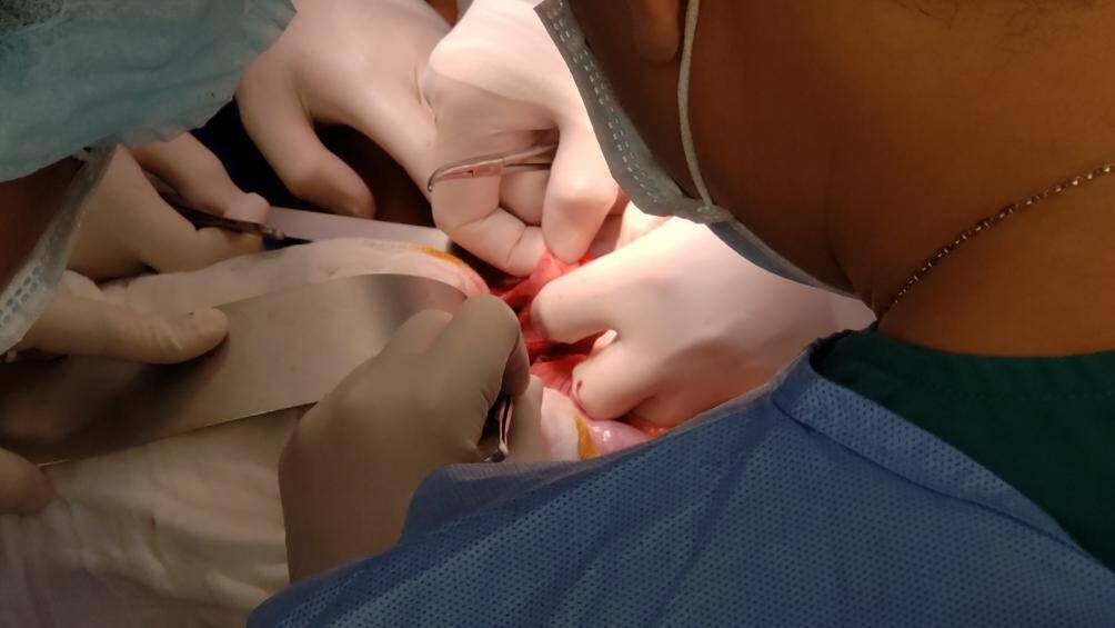 TS-BS Trương Quang Định, Giám đốc Bệnh viện Nhi đồng thành phố cho biết, kíp mổ gồm 93 thành viên chia thành 11 kíp, phụ trách nhiều khâu của ca phẫu thuật từ gây mê, dụng cụ, phẫu thuật ngoại tổng quát đến chỉnh hình, tạo hình, hồi sức, hồi sức trước mổ, chống nhiễm khuẩn, chẩn đoán hình ảnh và điều dưỡng.