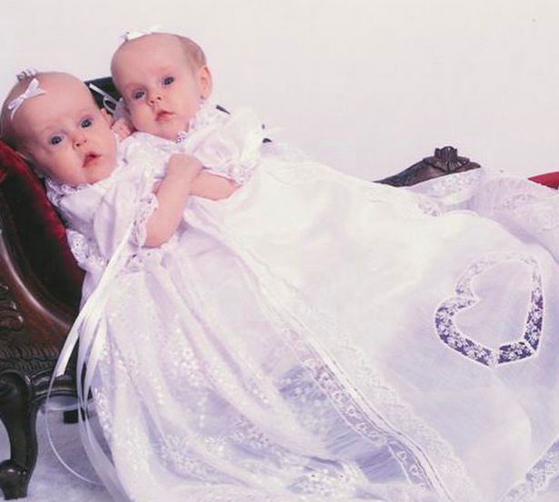 Sau nhiều tháng chuẩn bị, ngày 7/8/2006, hai bé gái 4 tuổi khi đó đã phải trải qua ca phẫu thuật tách rời kéo dài 18 giờ đồng hồ.