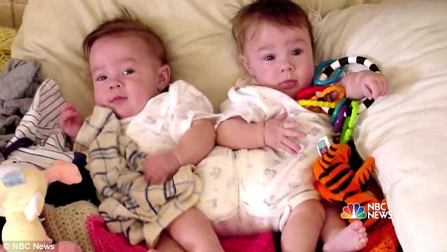 Ca phẫu thuật tách dính cho cặp đôi này diễn ra vào ngày 9/10/2001 và mỗi bé đã có một thân thể riêng biệt.