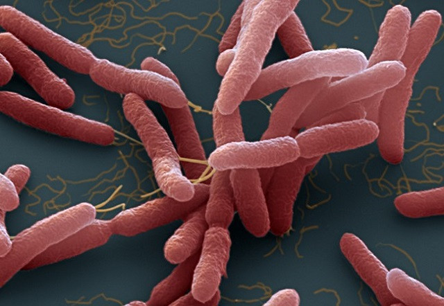 Ha Noi co ca Whitmore tien luong tu vong cao: Cach phong benh ra sao?