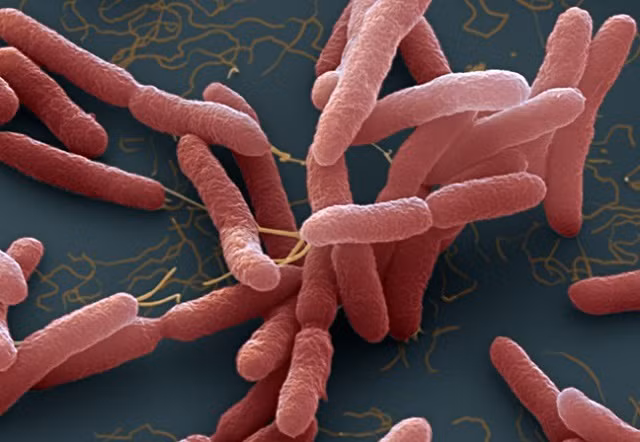 Ha Noi co ca Whitmore tien luong tu vong cao: Cach phong benh ra sao?