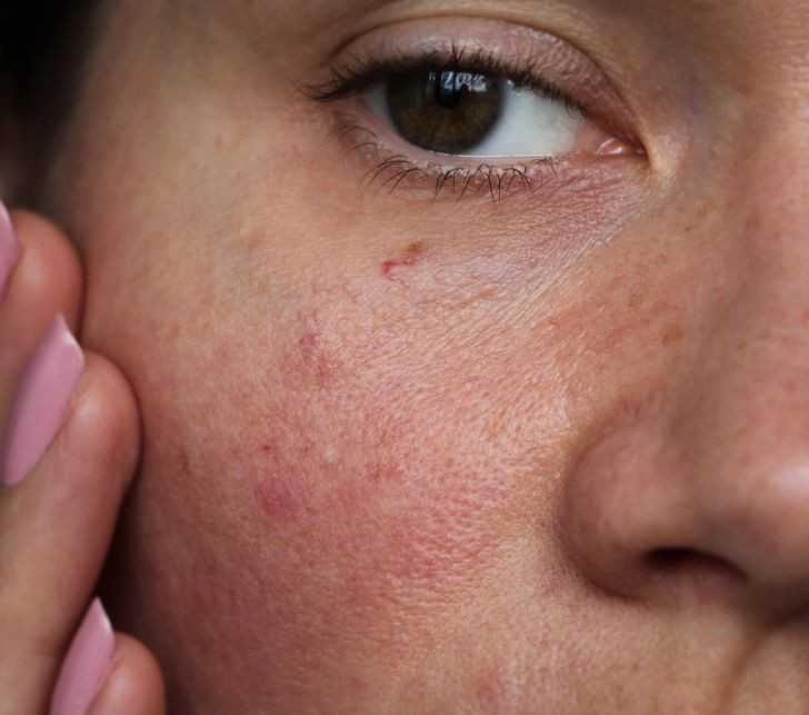 5 điều kỳ diệu xảy ra khi bạn tắm bằng nước lạnh - Hình 5 5 dieu ky dieu xay ra khi ban tam bang nuoc lanh-Hinh-5