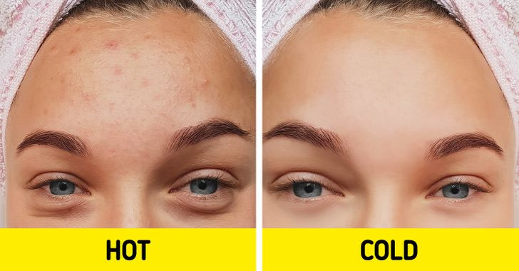 5 điều kỳ diệu xảy ra khi bạn tắm bằng nước lạnh - Hình 3 5 dieu ky dieu xay ra khi ban tam bang nuoc lanh-Hinh-3