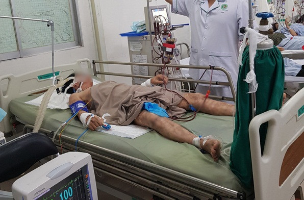 Hon me vi an bao tu ca mat tho: Ngo doc Tetrodotoxin cuc nguy hiem