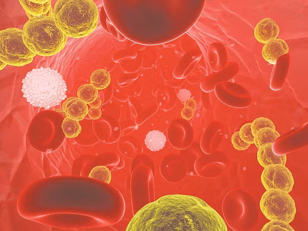 Can benh nhiem trung mau cap khien my nam Han qua doi nguy hiem ra sao?-Hinh-2