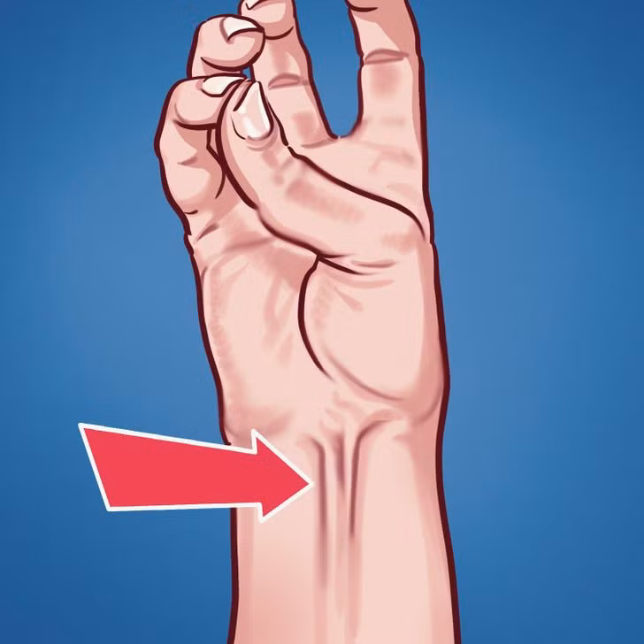 1. Cơ gan bàn tay: Hãy thử nắm ngửa tay ra và kéo căng phần cổ tay. Nếu bạn thấy có một chiếc gân nổi lên, thì bạn nằm trong số 10% dân số thế giới "may mắn" được sở hữu cơ gan bàn tay. Bộ phận vô dụng này được gọi là "long palmar muscle" - cơ gan tay, và nó... hoàn toàn vô dụng.