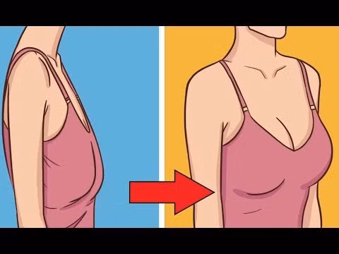 Ngoài ra, hút mỡ nâng ngực còn có thể có những biến chứng khác như nhiễm trùng dễ xảy ra ở cơ sở không đảm bảo điều kiện vô trùng và biến chứng hoại tử một phần hay toàn bộ lượng mỡ bơm vào do không được nuôi dưỡng đầy đủ.