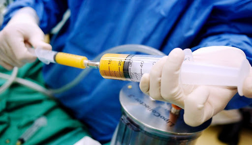 Biến chứng thuyên tắc mạch trong kỹ thuật bơm mỡ tự thân cũng có thể là nguyên nhân gây tử vong cho bệnh nhân. Cơ chế gây thuyên tắc là do trong quá trình thực hiện có thể có cục máu đông hay tế bào mỡ lọt vào mạch máu và di chuyển trong hệ mạch gây tắc mạch ở vùng nào đó của cơ thể. Nguy hiểm nhất là khi nó gây tắc mạch ở não hoặc phổi vì có thể gây ra nhiều rối loạn nặng nề cho bệnh nhân, thậm chí có thể gây tử vong.