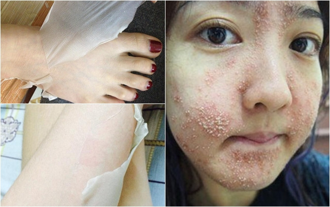 Theo bác sĩ Phượng, làm đẹp là nhu cầu chính đáng, nhưng nếu mù quáng, thiếu kiến thức có thể gây họa cho bản thân. Vì vậy, người dân cần tìm hiểu kỹ thông tin mỹ phẩm trước khi mua.